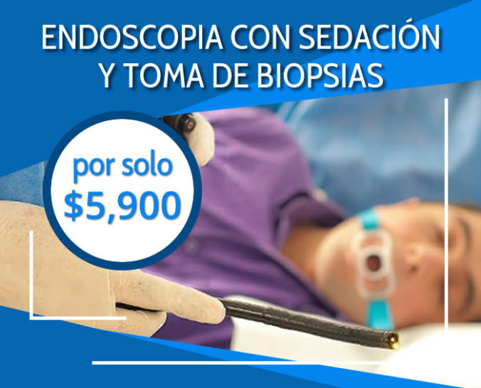 Endoscopía en Toluca