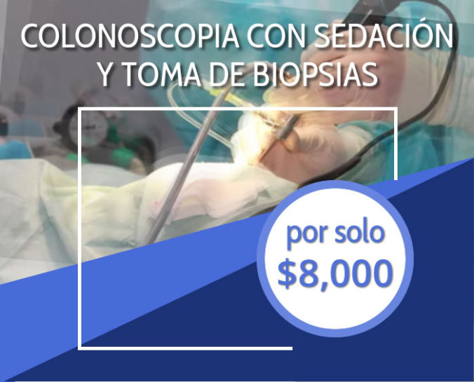 Colonoscopia en Toluca